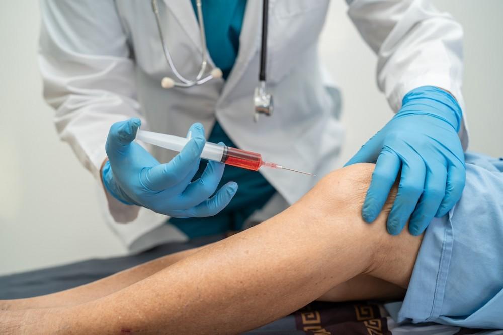 PRP for joint pain last