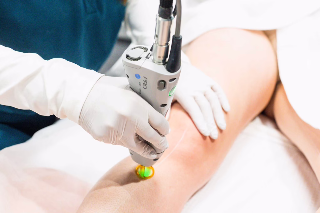 Laser Hair Removal In Raleigh